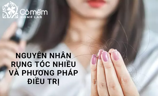 Nguyên nhân rụng tóc nhiều và phương pháp điều trị